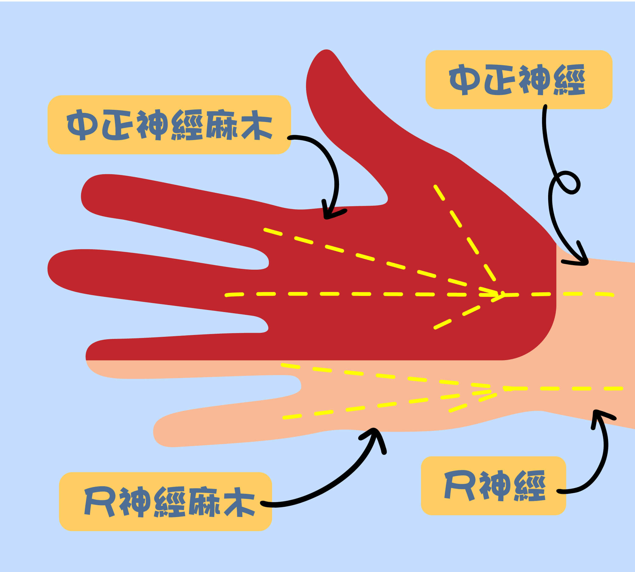 中正神經、尺神經